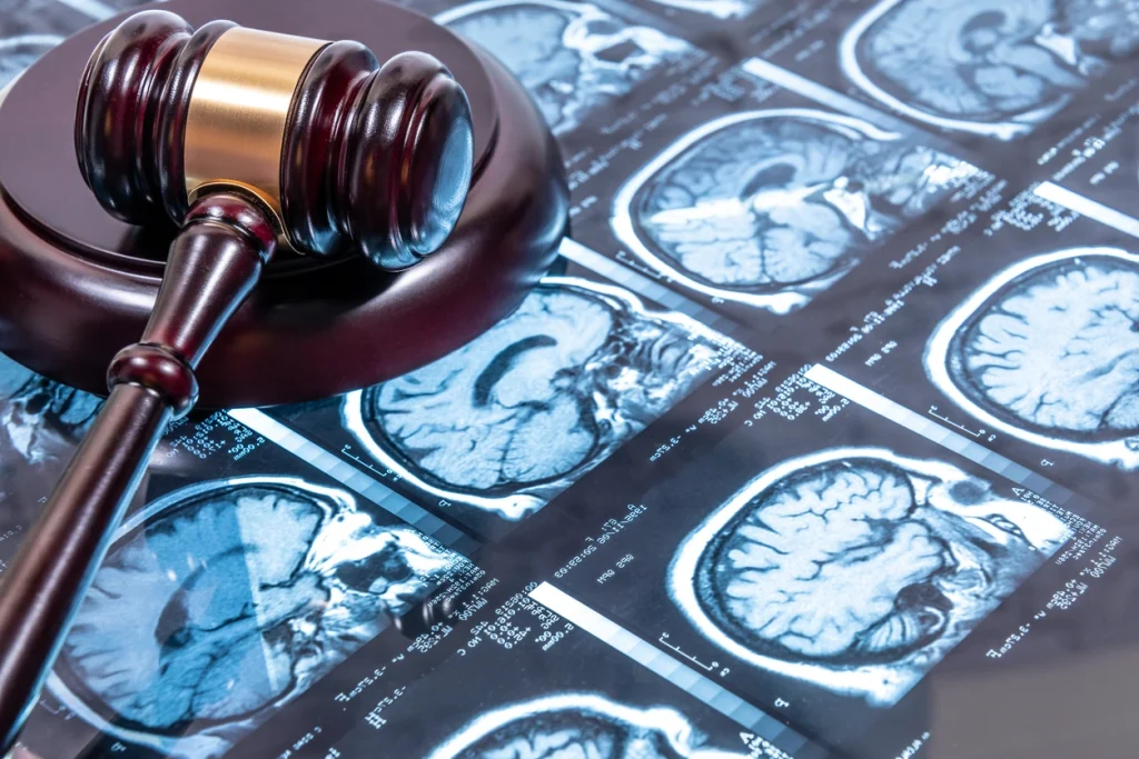 Charlotte experienced Brain Injury Attorneys